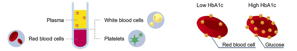 Blood components:Plasma, Red blood cells, White blood cells, Platelets. Low HbA1c(Red blood cell
), High HbA1c(Glucose)